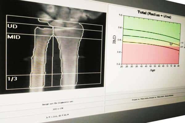 Peptides for Bone Density